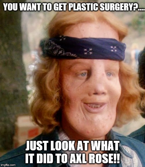 YOU WANT TO GET PLASTIC SURGERY?.... JUST LOOK AT WHAT IT DID TO AXL ROSE!! | image tagged in axl rose | made w/ Imgflip meme maker
