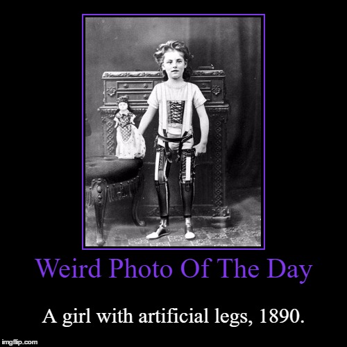We Humans, Never Stop Dreaming | image tagged in funny,demotivationals,weird,photo of the day,girl,artificial legs | made w/ Imgflip demotivational maker