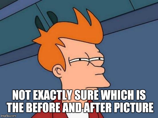 Futurama Fry | NOT EXACTLY SURE WHICH IS THE BEFORE AND AFTER PICTURE | image tagged in memes,futurama fry | made w/ Imgflip meme maker