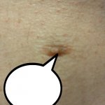 Sezmo's third nipple template