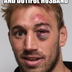 black eye | SO, ON 14TH FEBRUARY 2024, AS A LOVING AND DUTIFUL HUSBAND; I WISHED MY WIFE A HAPPY ASH WEDNESDAY... | image tagged in black eye | made w/ Imgflip meme maker