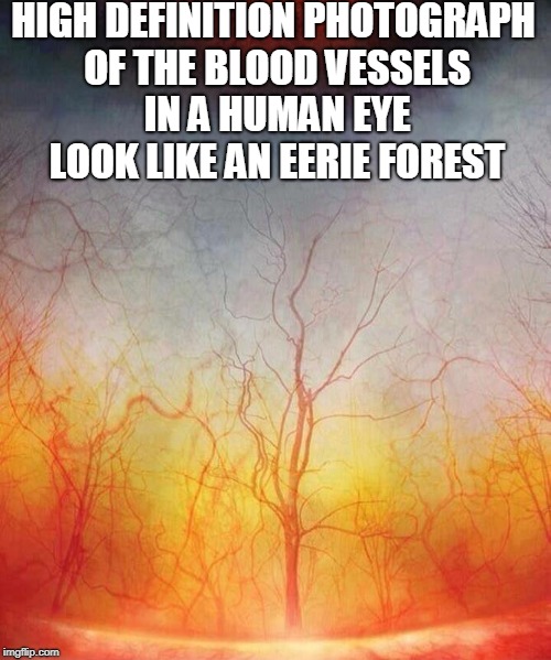High Definition Photography  | HIGH DEFINITION PHOTOGRAPH OF THE BLOOD VESSELS IN A HUMAN EYE LOOK LIKE AN EERIE FOREST | image tagged in high definition,hd,photography,eyeball,forest,memes | made w/ Imgflip meme maker