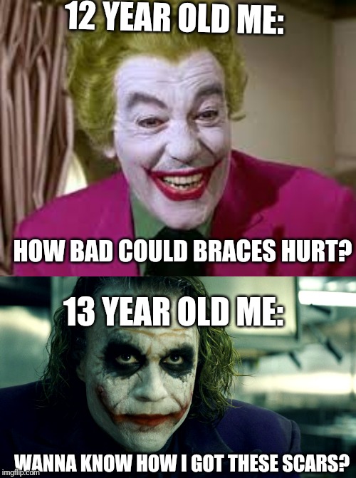 12 YEAR OLD ME:; HOW BAD COULD BRACES HURT? 13 YEAR OLD ME:; WANNA KNOW HOW I GOT THESE SCARS? | image tagged in wanna know how i got these scars,memes,funny,joker,braces | made w/ Imgflip meme maker