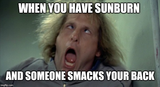 Scary Harry | WHEN YOU HAVE SUNBURN; AND SOMEONE SMACKS YOUR BACK | image tagged in memes,scary harry | made w/ Imgflip meme maker