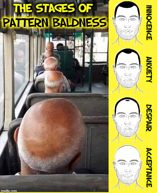 I'm Not Bald, but Suffer from Enlarged Forehead Syndrome | THE STAGES OF; PATTERN BALDNESS; INNOCENCE      ANXIETY        DESPAIR      ACCEPTANCE | image tagged in vince vance,bald,baldness,hair,enlarged forehead,pattern baldness | made w/ Imgflip meme maker