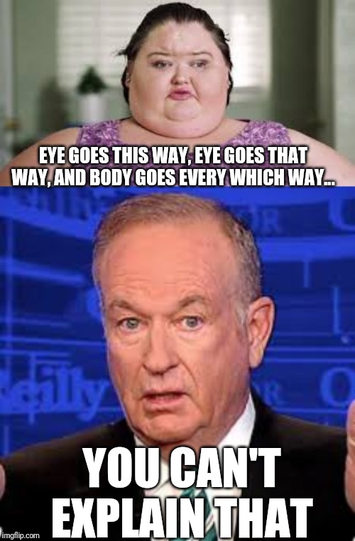 You Can't Explain That | EYE GOES THIS WAY, EYE GOES THAT WAY, AND BODY GOES EVERY WHICH WAY... YOU CAN'T EXPLAIN THAT | image tagged in bill o'reilly,fat,funny,1000 lbs sisters,amy slaton | made w/ Imgflip meme maker