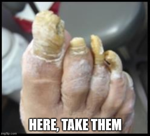 Ugly Toe Nails | HERE, TAKE THEM | image tagged in ugly toe nails | made w/ Imgflip meme maker