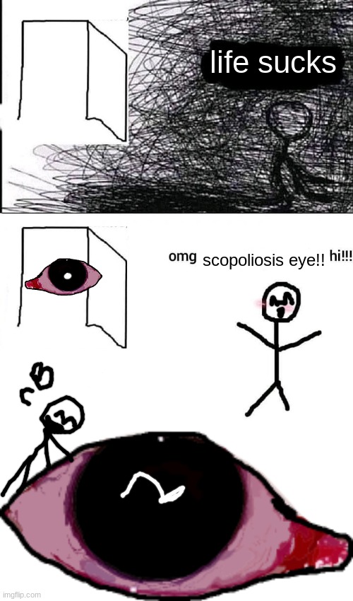 scopoliosis(not a ship just a wholesome thing) | life sucks; scopoliosis eye!! | image tagged in omg hi | made w/ Imgflip meme maker