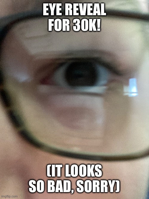 Yes, I wear glasses, but no, I don’t have vision problems | EYE REVEAL FOR 30K! (IT LOOKS SO BAD, SORRY) | made w/ Imgflip meme maker