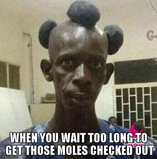 What's that on your head? | WHEN YOU WAIT TOO LONG TO GET THOSE MOLES CHECKED OUT | image tagged in mole,head | made w/ Imgflip meme maker