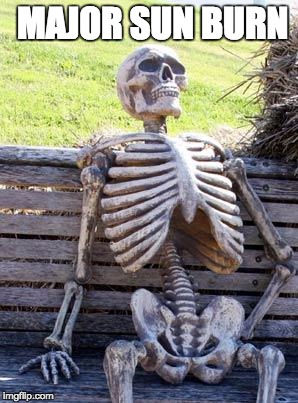 Waiting Skeleton | MAJOR SUN BURN | image tagged in memes,waiting skeleton | made w/ Imgflip meme maker