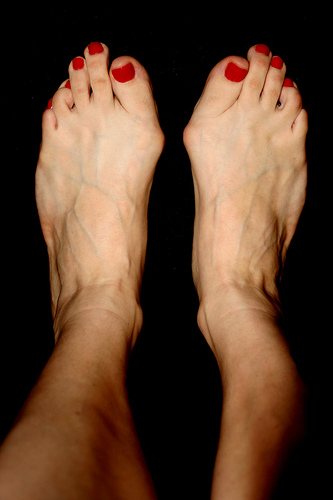 Pictures ugly feet Celebrities with