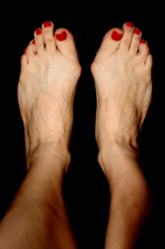 Ugly feet pictures