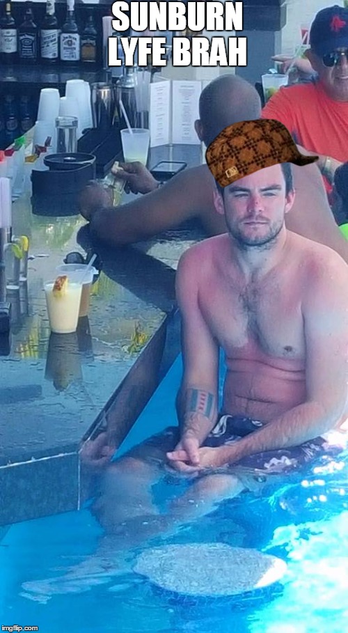 SUNBURN LYFE BRAH | image tagged in mitchell jfc,scumbag | made w/ Imgflip meme maker