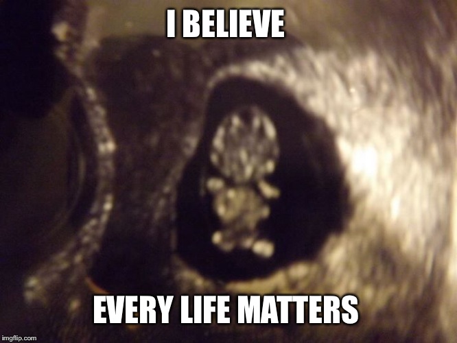 This is my daughter at 8 weeks and 4 days in the womb. Her heart was beating 3 weeks before this. Looks like a life to me. | I BELIEVE; EVERY LIFE MATTERS | image tagged in abortion,pro life,love | made w/ Imgflip meme maker