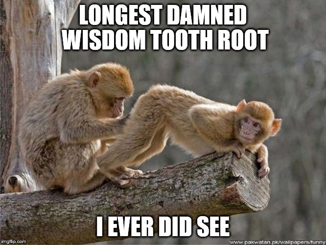 LONGEST DAMNED WISDOM TOOTH ROOT I EVER DID SEE | made w/ Imgflip meme maker