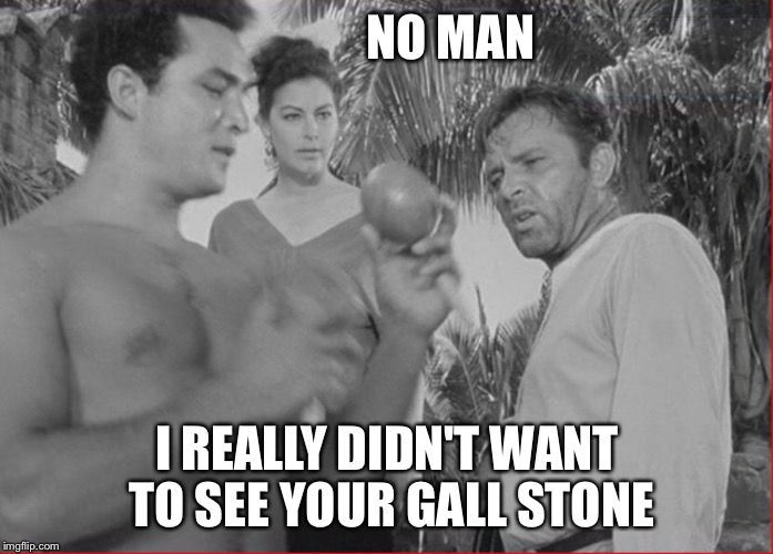 WHAT IS THIS? | NO MAN; I REALLY DIDN'T WANT TO SEE YOUR GALL STONE | image tagged in what is this | made w/ Imgflip meme maker
