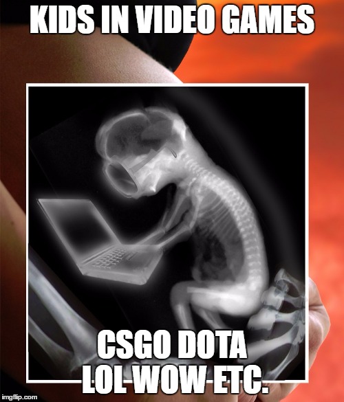 Fetus Using Laptop | KIDS IN VIDEO GAMES; CSGO DOTA LOL WOW ETC. | image tagged in fetus using laptop | made w/ Imgflip meme maker