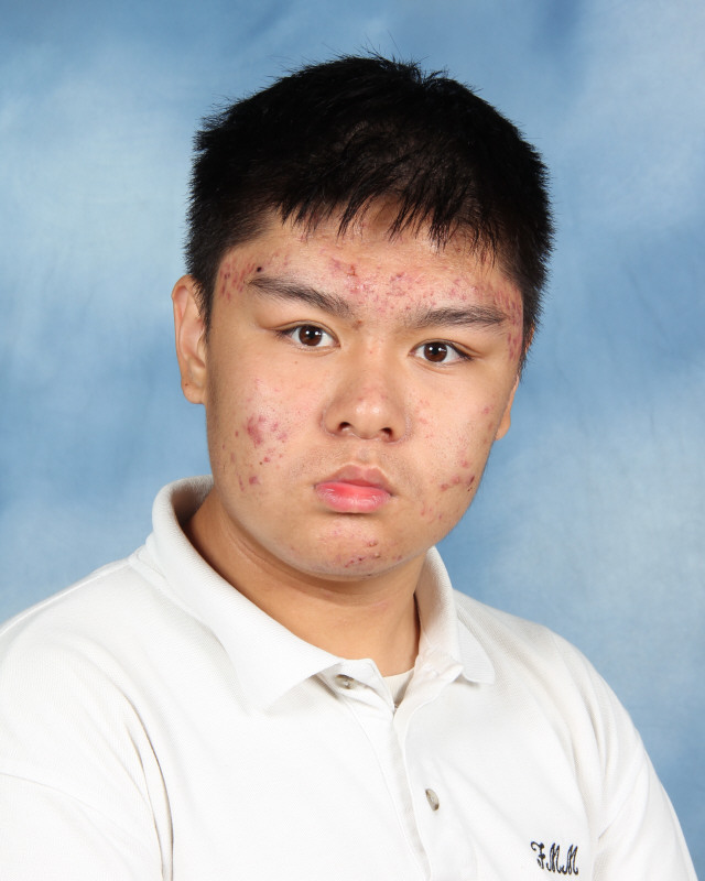 Acne Blank Meme Template