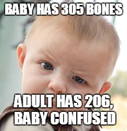 Skeptical Baby | BABY HAS 305 BONES; ADULT HAS 206, BABY CONFUSED | image tagged in memes,skeptical baby | made w/ Imgflip meme maker