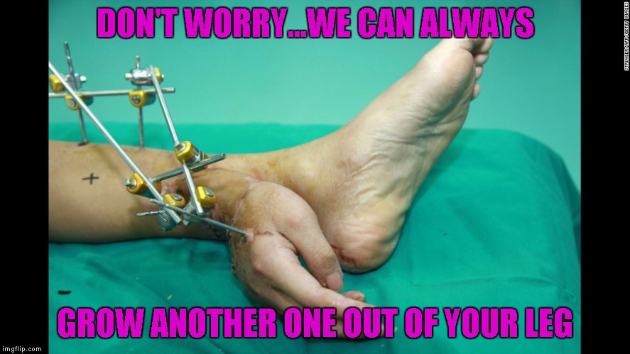 DON'T WORRY...WE CAN ALWAYS GROW ANOTHER ONE OUT OF YOUR LEG | made w/ Imgflip meme maker