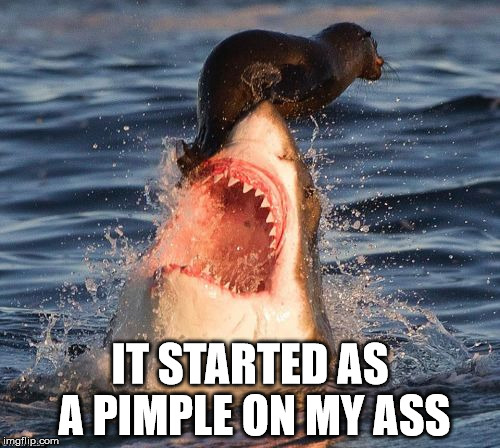Travelonshark | IT STARTED AS A PIMPLE ON MY ASS | image tagged in memes,travelonshark | made w/ Imgflip meme maker