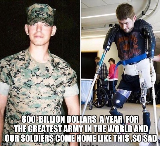 a life time of pain and suffering  | 800  BILLION DOLLARS  A YEAR  FOR THE GREATEST ARMY IN THE WORLD AND OUR SOLDIERS COME HOME LIKE THIS ,SO SAD | image tagged in war | made w/ Imgflip meme maker