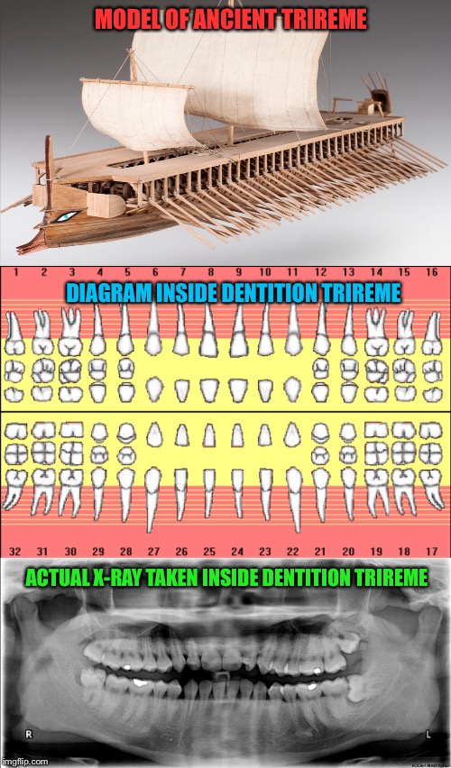 THREE MODERN RENDITIONS OF ANCIENT GREEK TRIREMES | MODEL OF ANCIENT TRIREME; DIAGRAM INSIDE DENTITION TRIREME; ACTUAL X-RAY TAKEN INSIDE DENTITION TRIREME | image tagged in ships | made w/ Imgflip meme maker