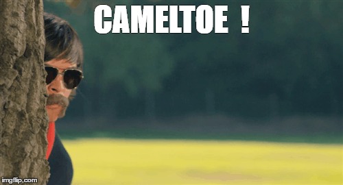 CAMELTOE  ! | image tagged in cameltoe spy | made w/ Imgflip meme maker