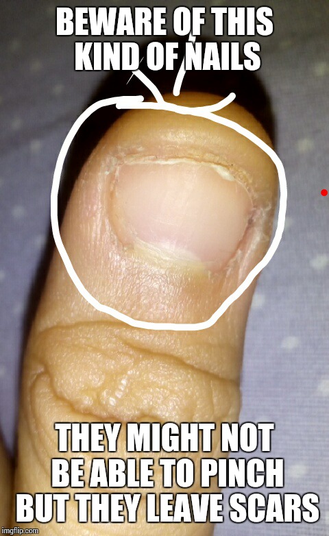 BEWARE OF THIS KIND OF NAILS; THEY MIGHT NOT BE ABLE TO PINCH BUT THEY LEAVE SCARS | image tagged in x x everywhere | made w/ Imgflip meme maker