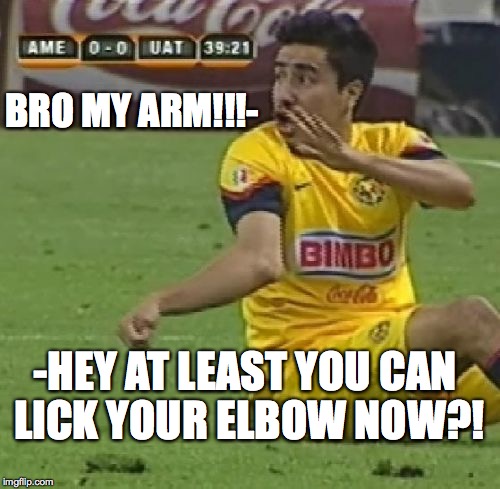 Efrain Juarez |  BRO MY ARM!!!-; -HEY AT LEAST YOU CAN LICK YOUR ELBOW NOW?! | image tagged in memes,efrain juarez | made w/ Imgflip meme maker