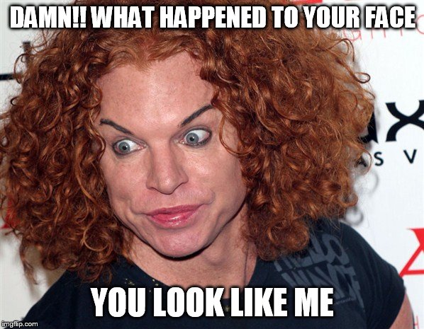 Carrot Top | DAMN!! WHAT HAPPENED TO YOUR FACE YOU LOOK LIKE ME | image tagged in carrot top | made w/ Imgflip meme maker