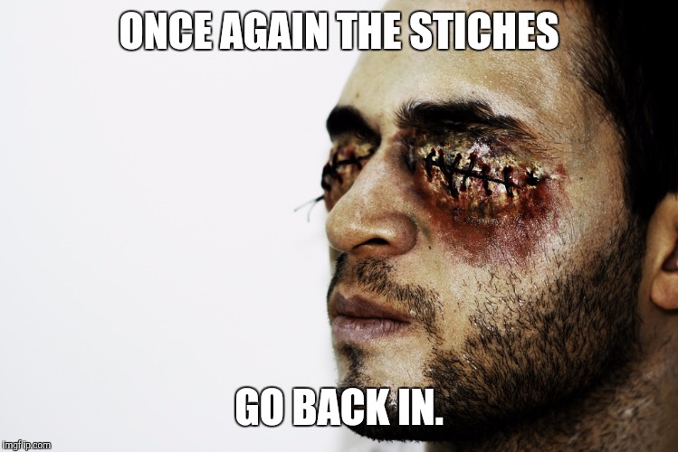ONCE AGAIN THE STICHES GO BACK IN. | made w/ Imgflip meme maker