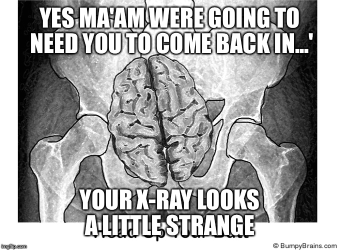 Hillarys Brain  | YES MA'AM WERE GOING TO NEED YOU TO COME BACK IN...' YOUR X-RAY LOOKS A LITTLE STRANGE | image tagged in hillarys brain | made w/ Imgflip meme maker