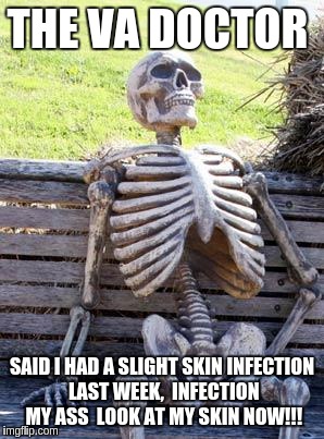 Waiting Skeleton | THE VA DOCTOR; SAID I HAD A SLIGHT SKIN INFECTION LAST WEEK,  INFECTION MY ASS  LOOK AT MY SKIN NOW!!! | image tagged in memes,waiting skeleton | made w/ Imgflip meme maker