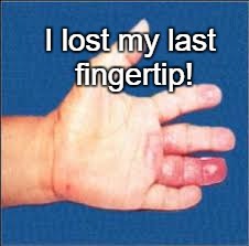 I lost my last fingertip! | made w/ Imgflip meme maker