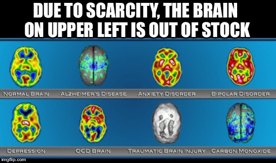 Brain Scans | DUE TO SCARCITY, THE BRAIN ON UPPER LEFT IS OUT OF STOCK | image tagged in brains | made w/ Imgflip meme maker