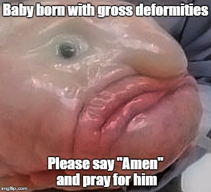 baby born with gross deformities | Baby born with gross deformities; Please say "Amen" and pray for him | image tagged in jesus,god,bible,religion | made w/ Imgflip meme maker