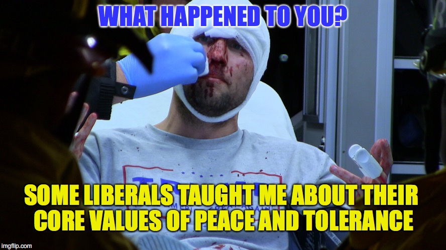 Peace and Love - My Ass! | WHAT HAPPENED TO YOU? SOME LIBERALS TAUGHT ME ABOUT THEIR CORE VALUES OF PEACE AND TOLERANCE | image tagged in victim of liberalism | made w/ Imgflip meme maker