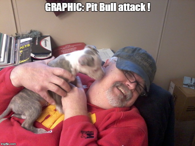 Nasty pit bull attack | GRAPHIC: Pit Bull attack ! | image tagged in memes | made w/ Imgflip meme maker