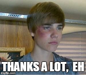 THANKS A LOT,  EH | image tagged in justin bruised | made w/ Imgflip meme maker