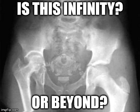 x-ray Memes & GIFs - Imgflip