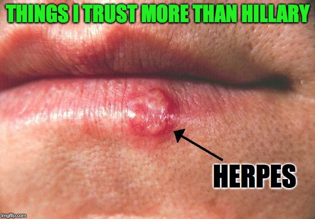 I can think of a lot more things. | THINGS I TRUST MORE THAN HILLARY; HERPES | image tagged in memes,funny,hillary clinton,hillary emails,trust,lol | made w/ Imgflip meme maker