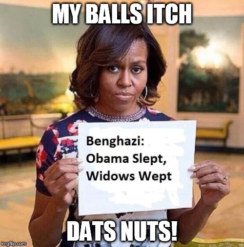 Michelle Obama | MY BALLS ITCH; DATS NUTS! | image tagged in michelle obama | made w/ Imgflip meme maker
