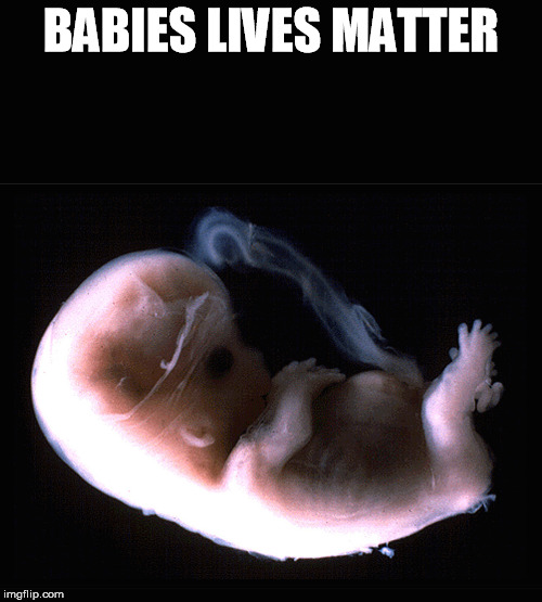 Fetus | BABIES LIVES MATTER | image tagged in fetus | made w/ Imgflip meme maker