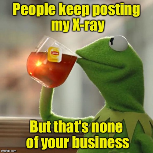That's none of your business  | People keep posting my X-ray; But that's none of your business | image tagged in memes,but thats none of my business,kermit the frog | made w/ Imgflip meme maker