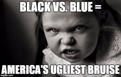 Bruise | BLACK VS. BLUE =; AMERICA'S UGLIEST BRUISE | image tagged in stopthehate | made w/ Imgflip meme maker