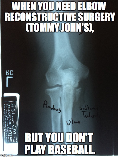 I need reconstructive elbow surgery. | WHEN YOU NEED ELBOW RECONSTRUCTIVE SURGERY (TOMMY JOHN'S), BUT YOU DON'T PLAY BASEBALL. | image tagged in fractured sublime tubercle | made w/ Imgflip meme maker