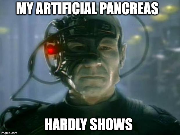 Locutus of Borg | MY ARTIFICIAL PANCREAS; HARDLY SHOWS | image tagged in locutus of borg | made w/ Imgflip meme maker