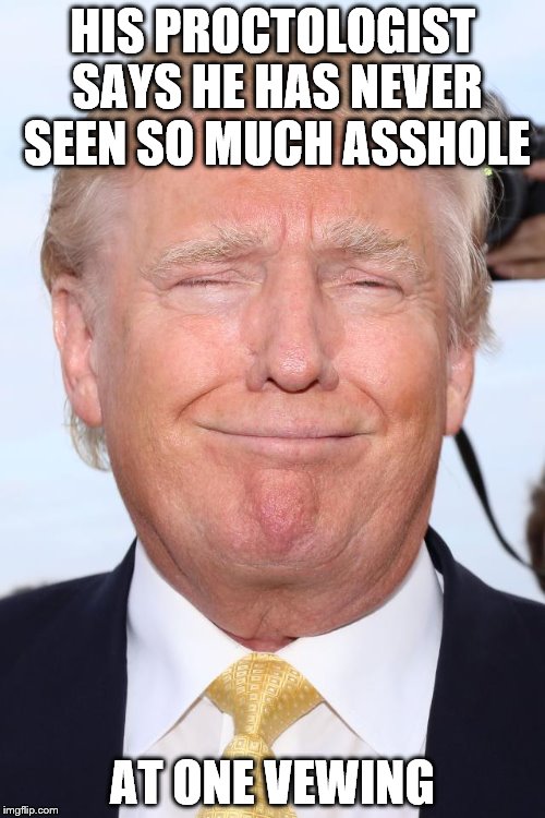 say ahh | HIS PROCTOLOGIST SAYS HE HAS NEVER SEEN SO MUCH ASSHOLE; AT ONE VEWING | image tagged in trump laughing,never trump | made w/ Imgflip meme maker